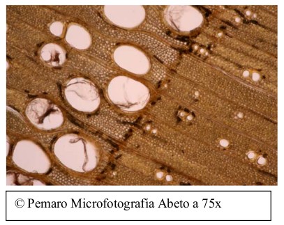Microfotografía de abeto a 75 aumentos (traqueidas)