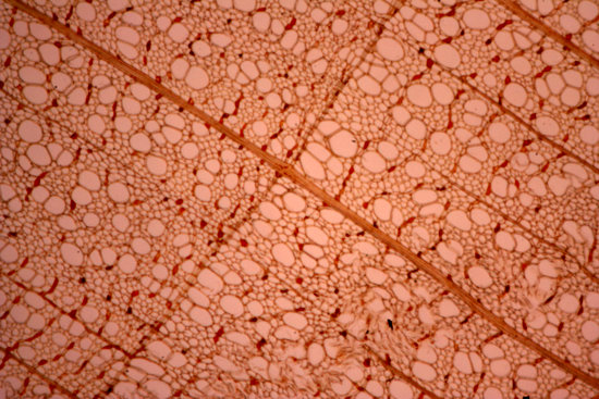 15micrografa021_tilia_plathypillos_tilo